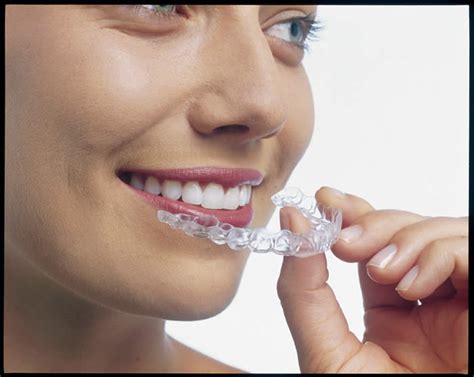 Invisalign Treatment System .